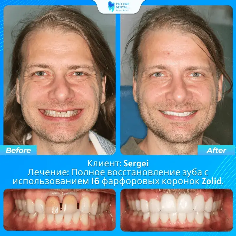 До и после