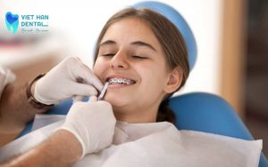 Nieng Rang Mac Cai 4