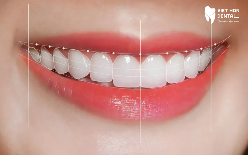 Thời gian tồn tại của răng sứ có thể lên đến 15 năm