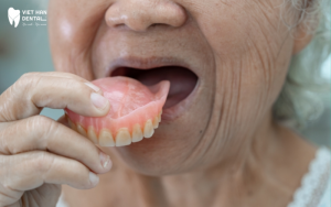 Ưu điểm của hàm giả tháo lắp 