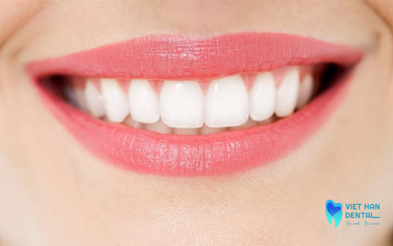 Màu răng sứ màu tương đồng với răng thật