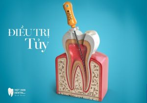 Dieu Tri Tuy