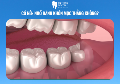ảnh Bìa Website (52)