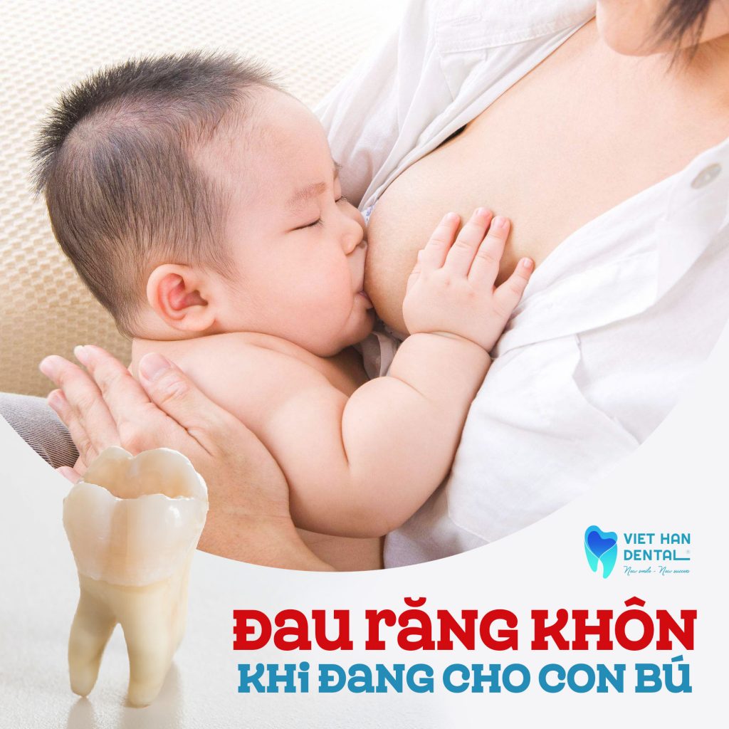 Đau răng khôn có cho con bú được không?