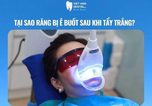 Tại sao răng bị ê buốt sau khi tẩy trắng?