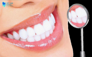 Tại sao nên tẩy trắng răng?