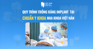 Quy trình trồng răng Implant chuẩn Y khoa tại Nha khoa Việt Hàn