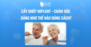 Cấy ghép Implant chăm sóc răng như thế nào đúng cách?