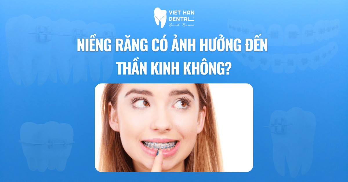 Niềng răng có ảnh hưởng đến thần kinh hay không?