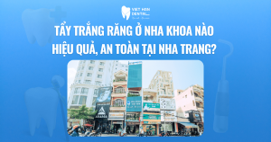 Tẩy trắng răng ở nha khoa nào hiệu quả, an toàn tại Nha Trang?