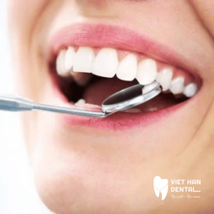 Tẩy trắng răng – giải pháp mang lại nụ cười tỏa sáng