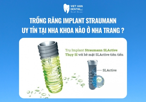 Trụ Implant Straumann