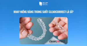 Khay niềng răng trong suốt ClearCorrect