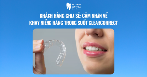 Khách hàng chia sẻ: Cảm nhận về khay niềng răng trong suốt ClearCorrect