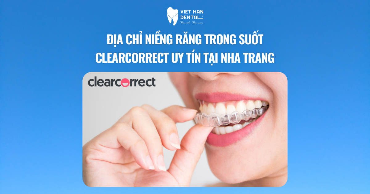 Địa chỉ niềng răng bằng máng niềng trong suốt Clearcorrect uy tín tại Nha Trang