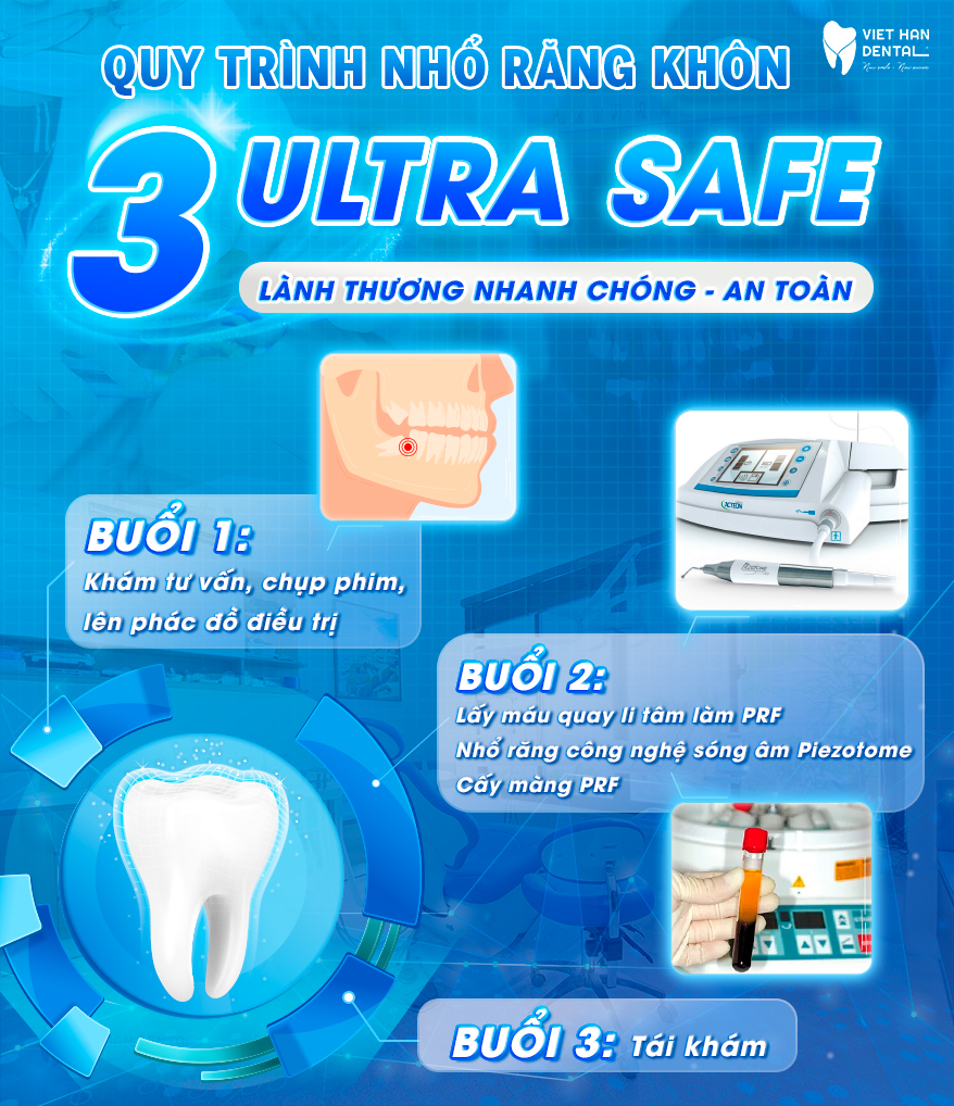 Công nghệ nhổ răng khôn 3 Ultra Safe tại Nha khoa Việt Hàn