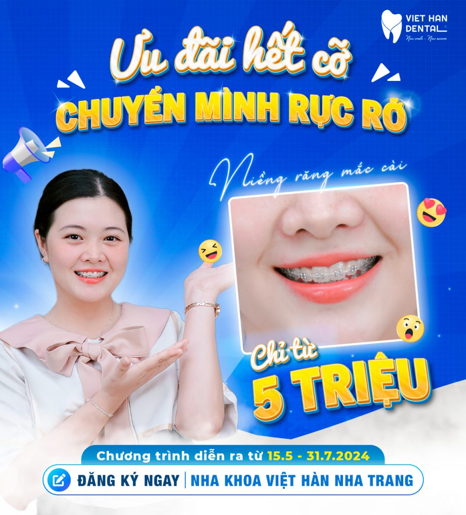 Niềng răng chỉ với 5.000.000đ - Ưu đãi đặc biệt mùa hè!