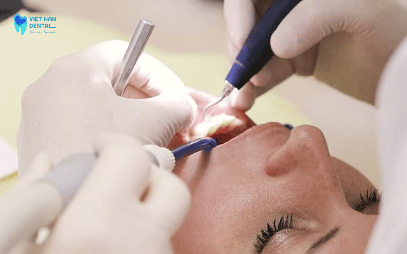 Kỹ thuật tinh chỉnh trong quá trình niềng răng Invisalign