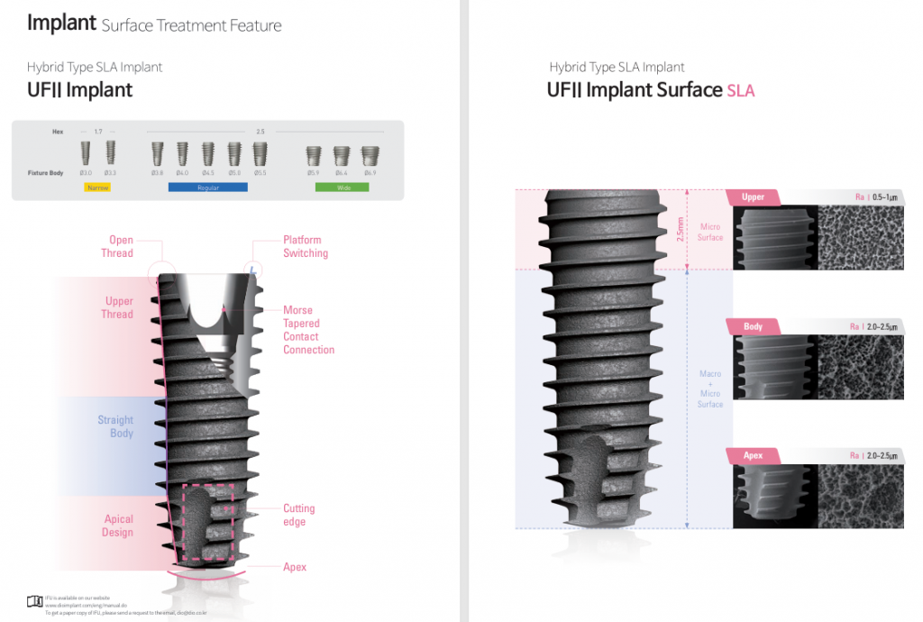 Trụ Implant Sla