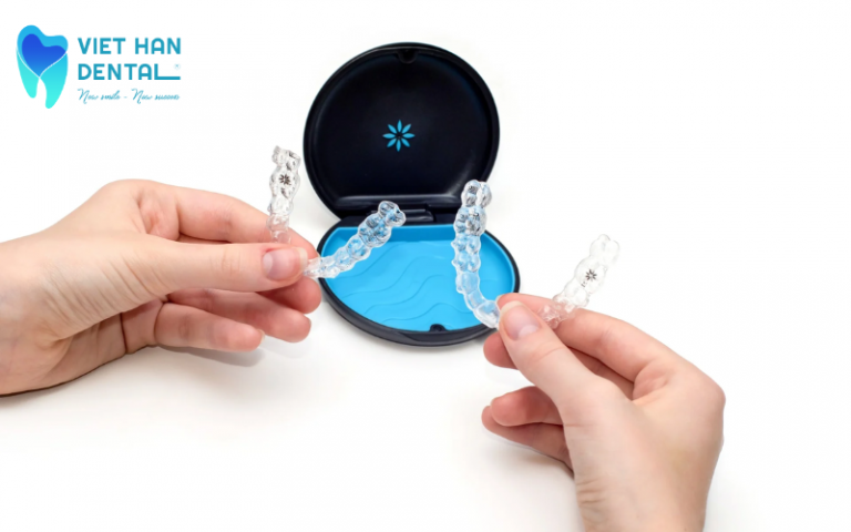 Niềng răng Invisalign Express là gì?