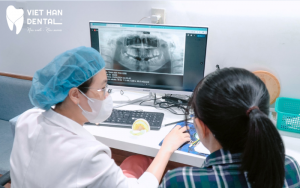 Tiêu xương hàm có niềng răng được không?