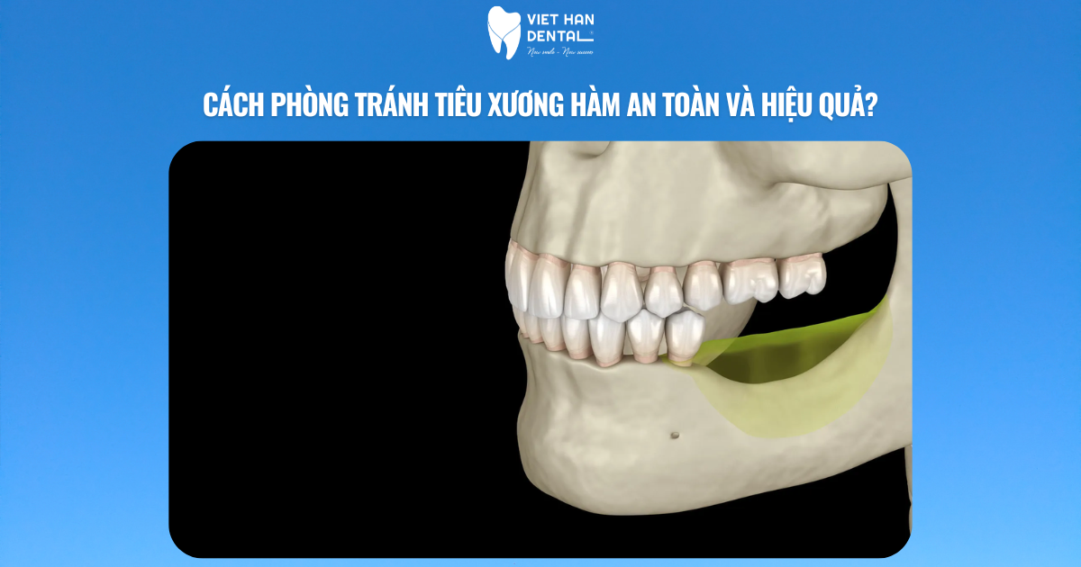 Cách phòng tránh tiêu xương hàm an toàn và hiệu quả?