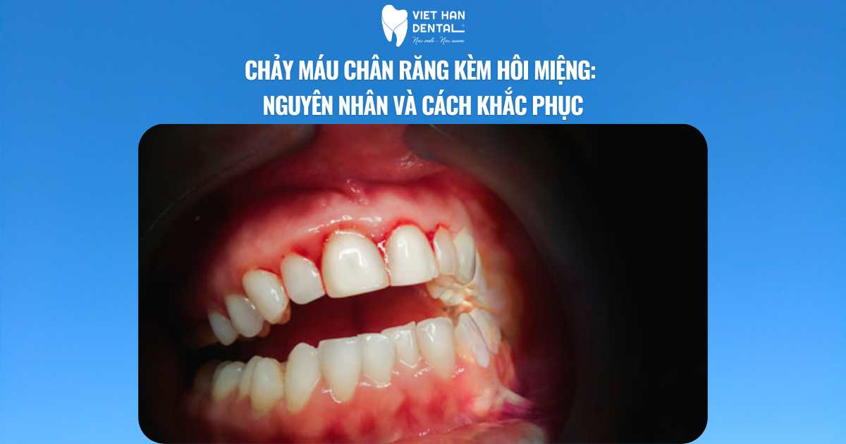 Chảy máu chân răng kèm hôi miệng: Nguyên nhân và cách khắc phục