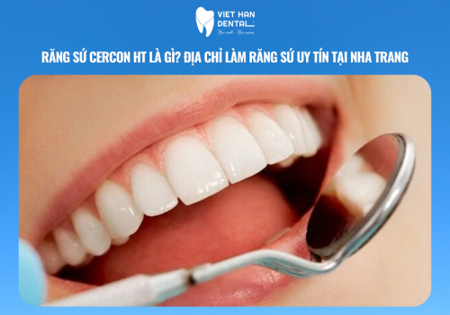 Răng sứ Cercon HT là gì? Địa chỉ làm răng sứ uy tín tại Nha Trang