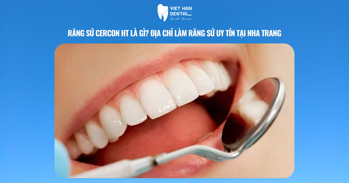 Răng sứ Cercon HT là gì? Địa chỉ làm răng sứ uy tín tại Nha Trang