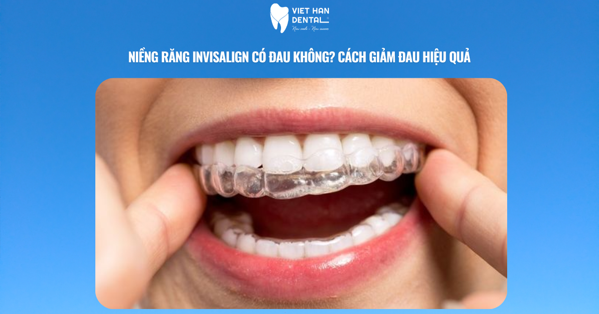 Niềng răng Invisalign