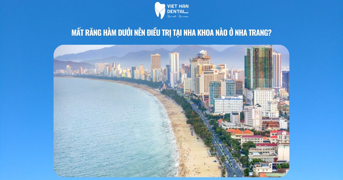 Mất răng hàm dưới nên điều trị tại nha khoa nào ở Nha Trang?