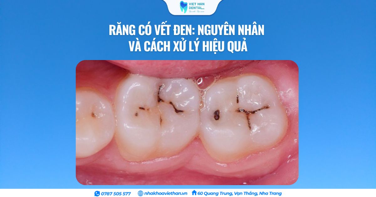 Cover Web (19)