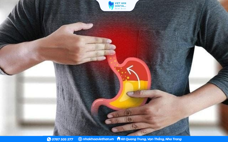 Trào ngược dạ dày