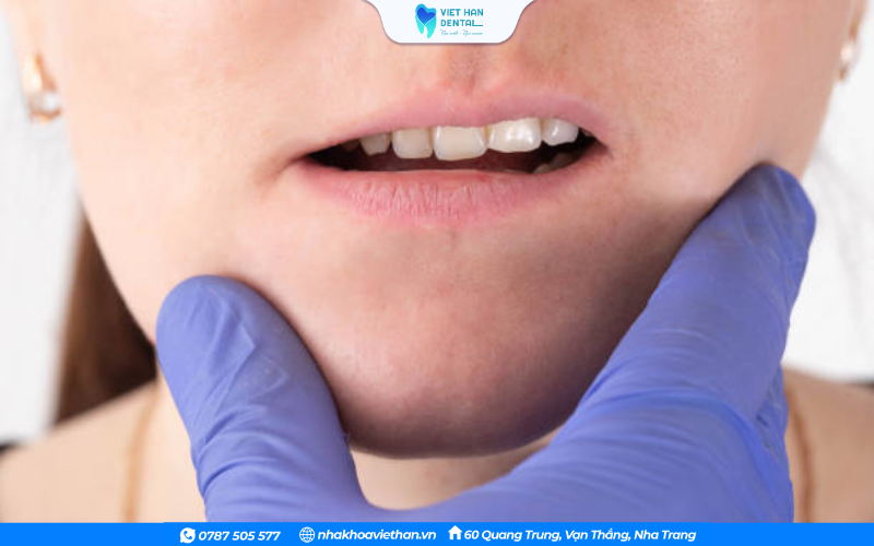Mất răng hoặc mọc răng không đúng vị trí là một trong số các nguyên nhân dẫn đến lệch hàm