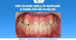 Cover Web (18)