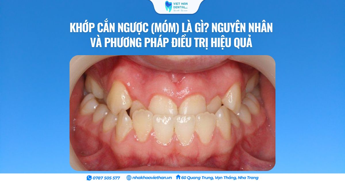 Cover Web (18)
