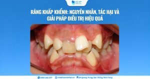 Cover Web (30)