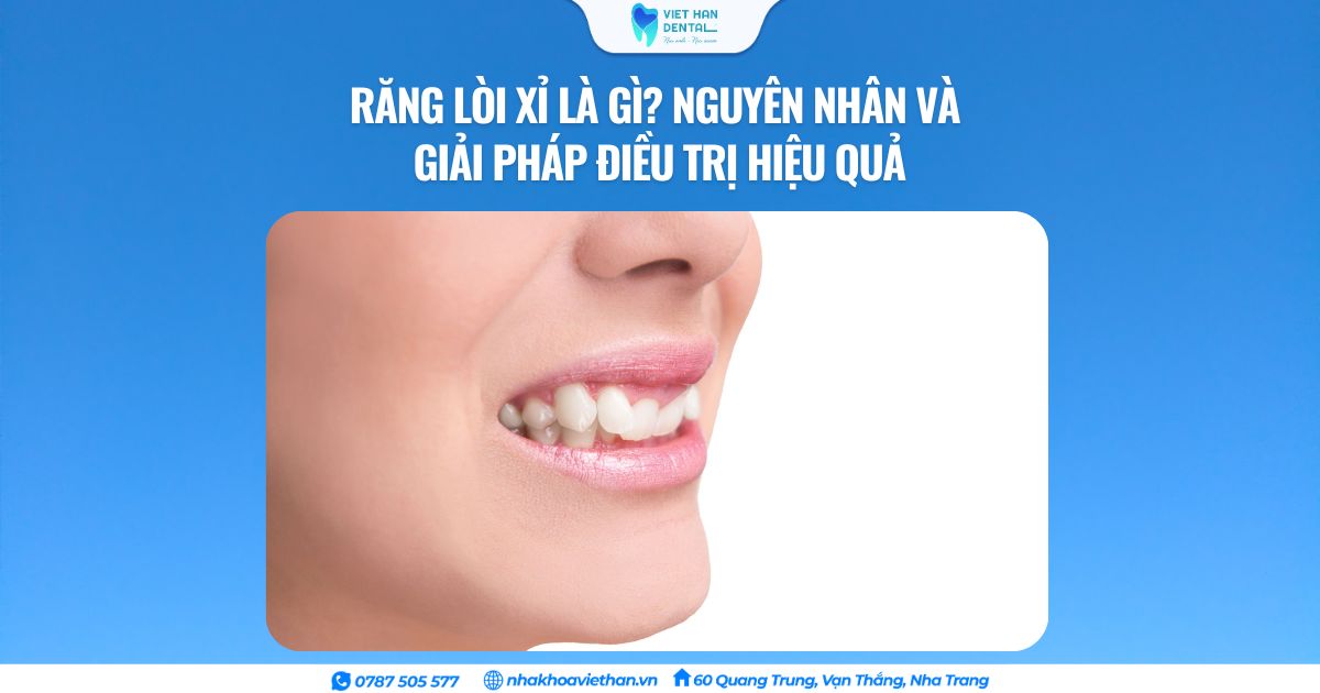 Cover Web (30)