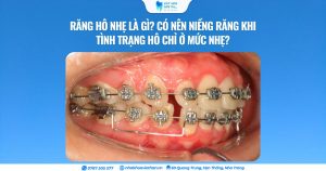 Cover Web (30)
