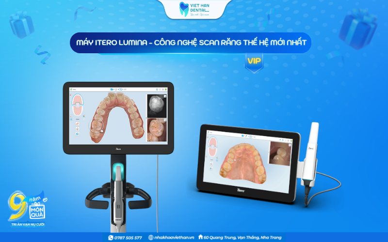 Máy Itero Limina - Công nghệ Scan răng thế hệ mới nhất