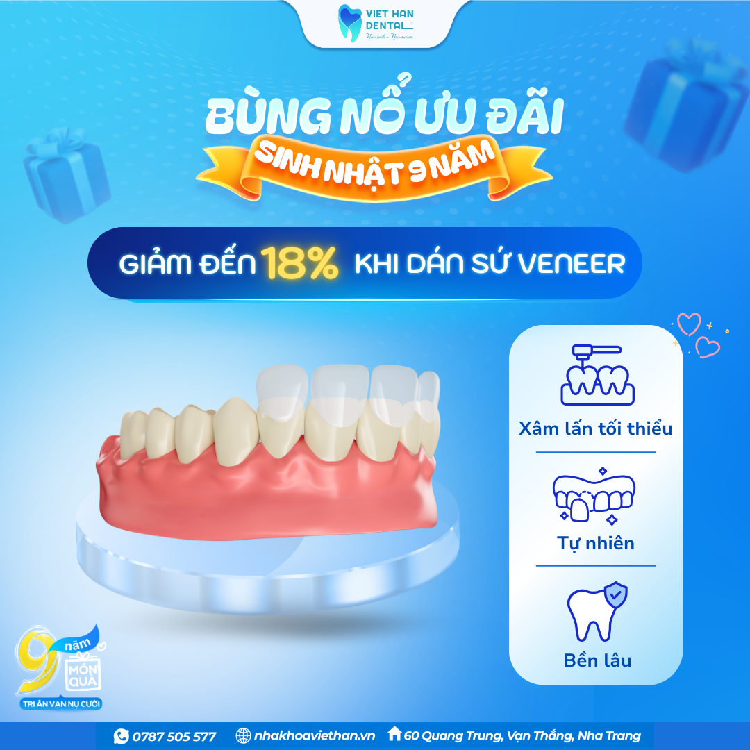 Ưu đãi dịch vụ dán răng sứ Veneer tại Nha khoa Việt Hàn