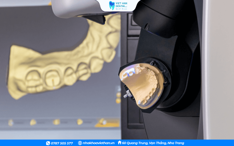 Ứng dụng công nghệ CAD/CAM trong phục hình răng sứ