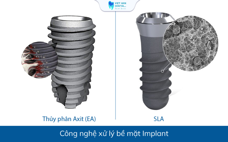 Công nghệ xử lý bề mặt trụ Implant