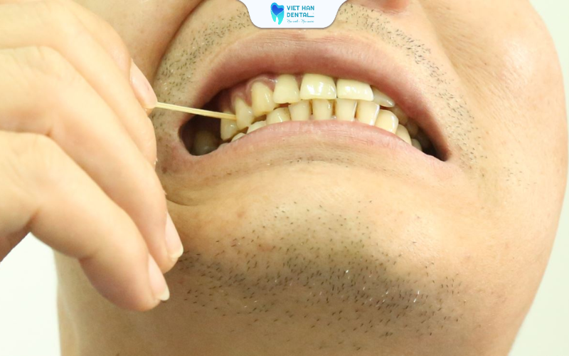 Bỏ các thói quen gây hại cho răng