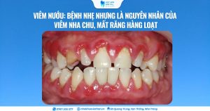 Cover Web (48)