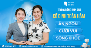 Trồng Implant Hàm Trên (1)