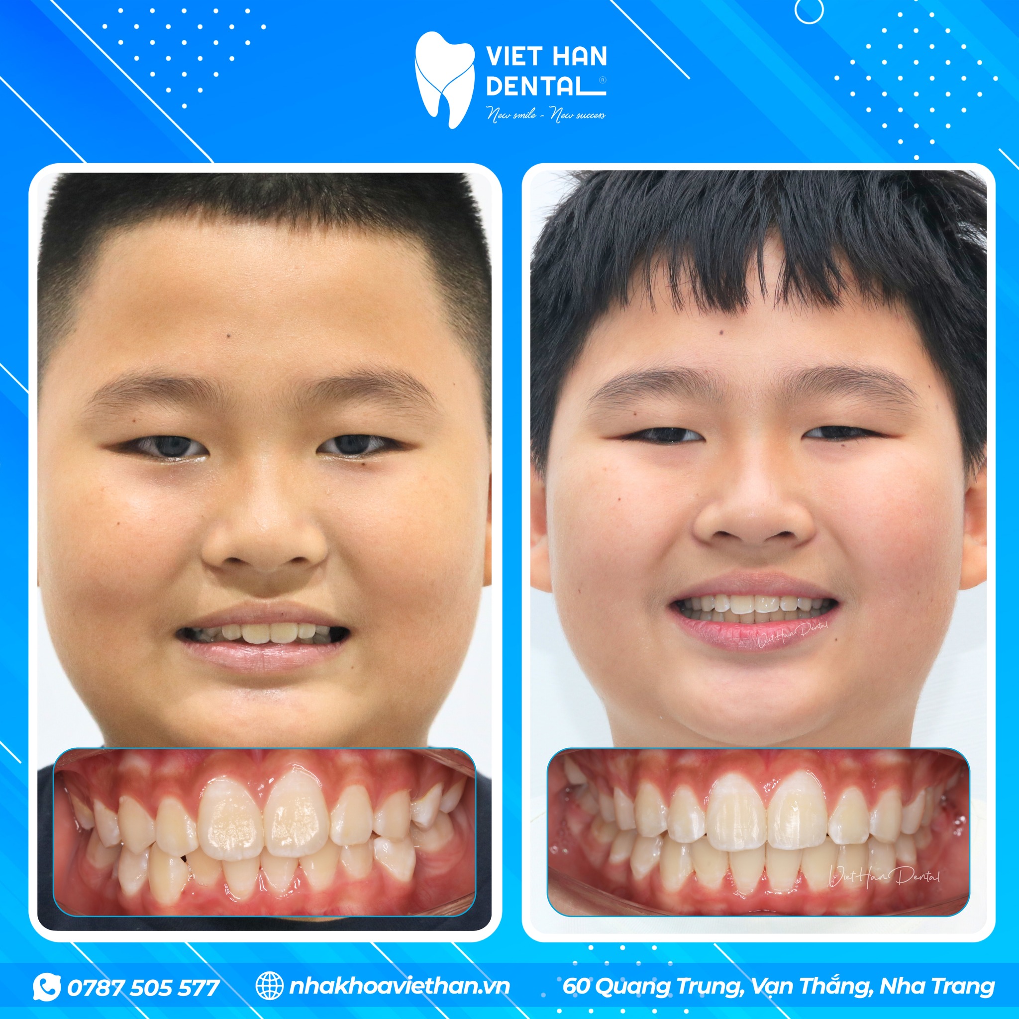 505886212 122155849346385286 3795948461406338604 N