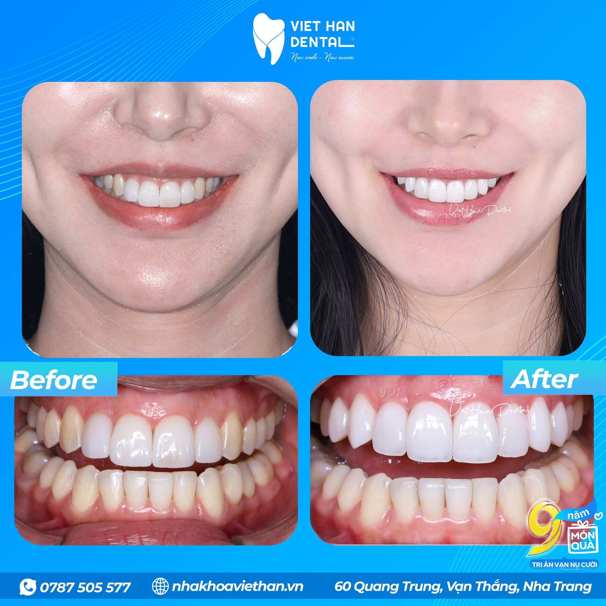 561250865 122170872350385286 4901533302796091860 N