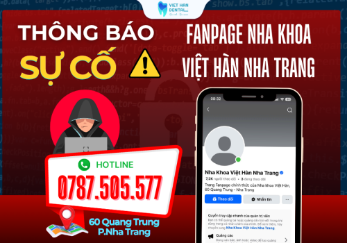 Thông Báo Sự Cố
