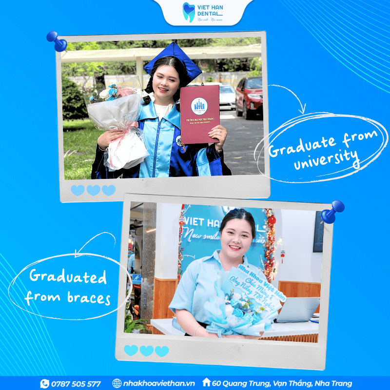 Thuy My graduated from university and also graduated from Viet Han Orthodontics.